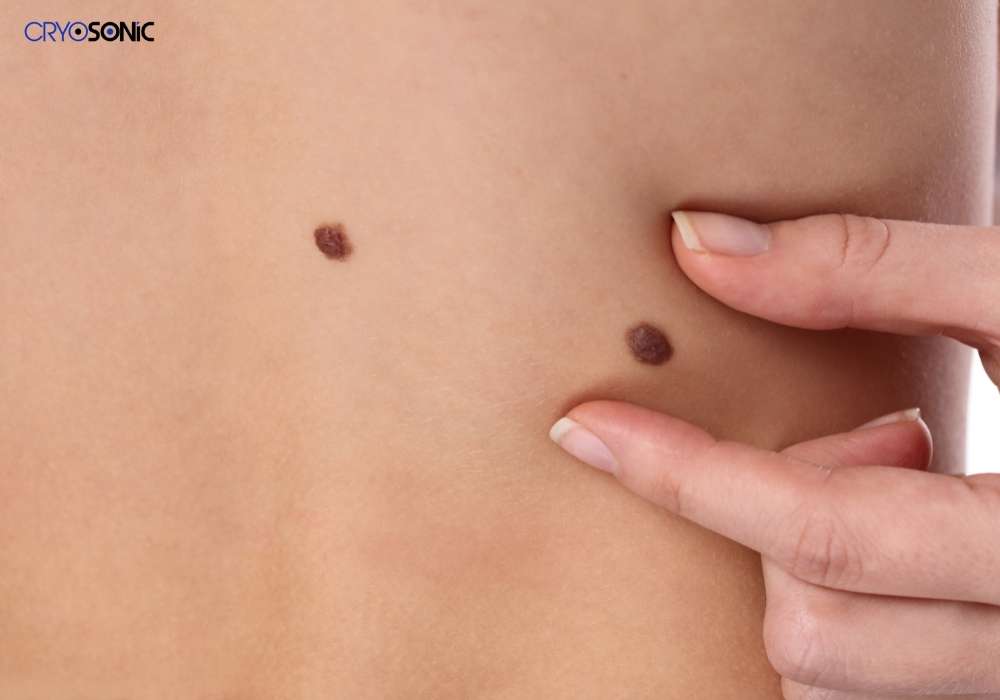 Infection Risk and Poor Aftercare Poole
