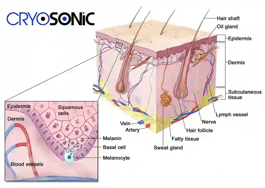 How Cryotherapy Stimulates Melanocyte Activity  Poole